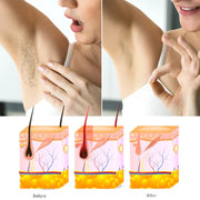 Heaven Dove Hair Removal Spray (Unisex)