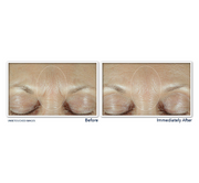 ROC Derm Correxion Fill + Treat Serum