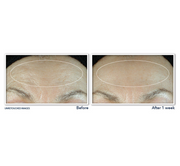 ROC Retinol Correxion Line Smoothing Daily Serum