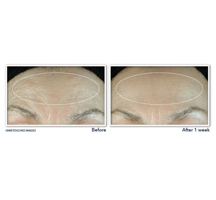 ROC Retinol Correxion Line Smoothing Daily Serum