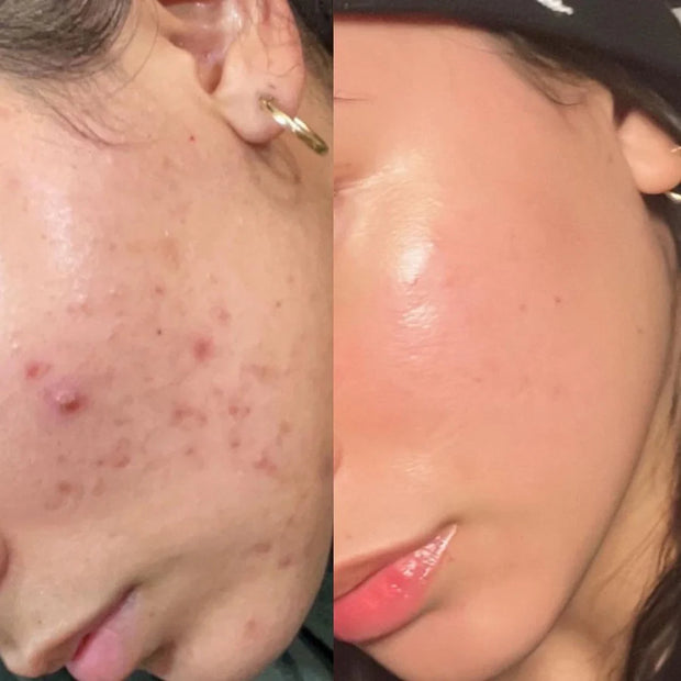 The Ordinary Face Wash